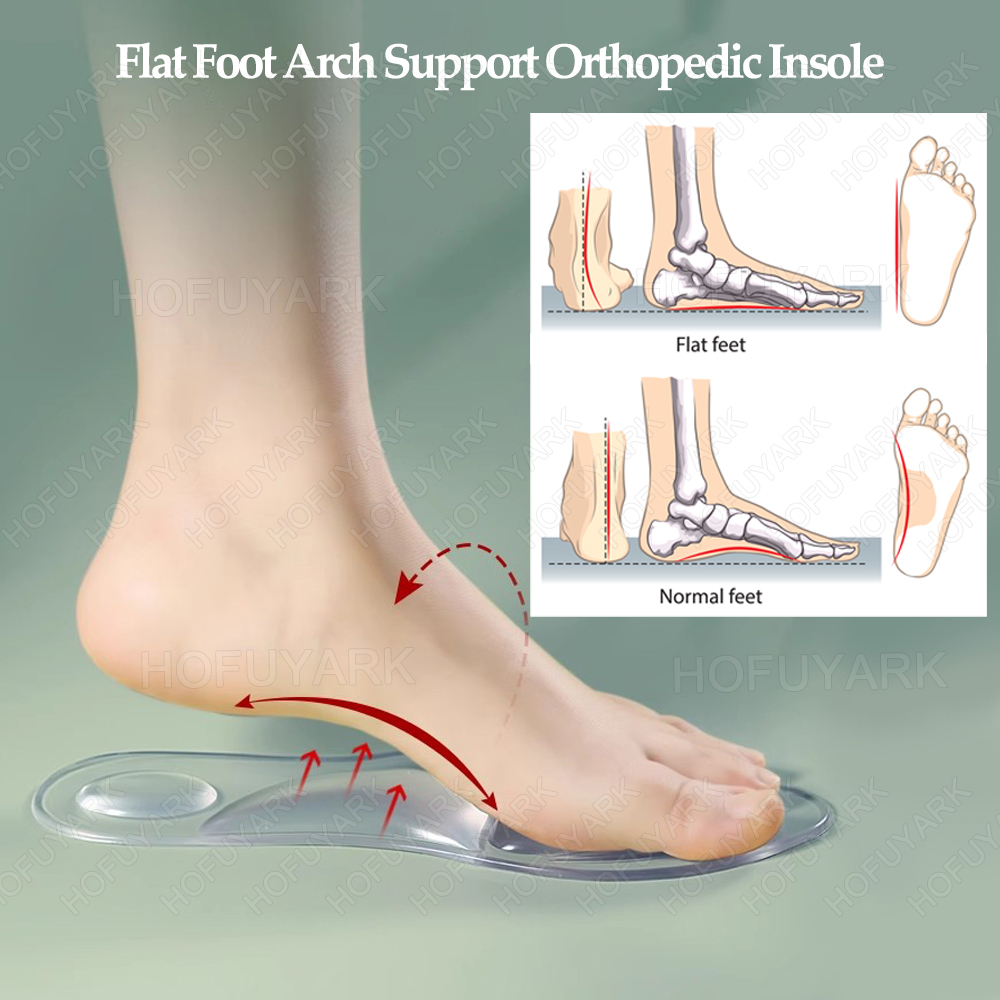 Silicone Gel Insoles Orthopedi - Women'S Shoes Plantar Fasciitis ulasan dan harga